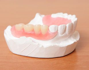 دندانسازی منطقه ۴