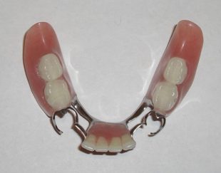 دندان مصنوعی با بیمه