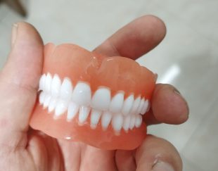 دندانسازی ارزان قیمت