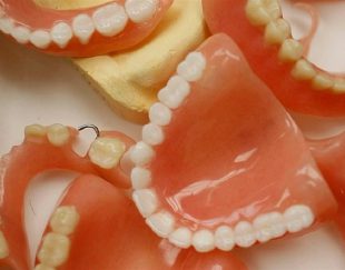 دندان مصنوعی کامپوزیتی