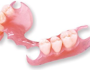 دندان کامپوزیتی