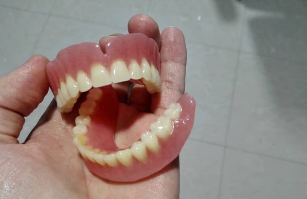 دندان مصنوعی با تعرفه بیمه