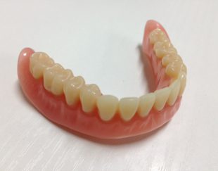 دندان مصنوعی طرح لبخند
