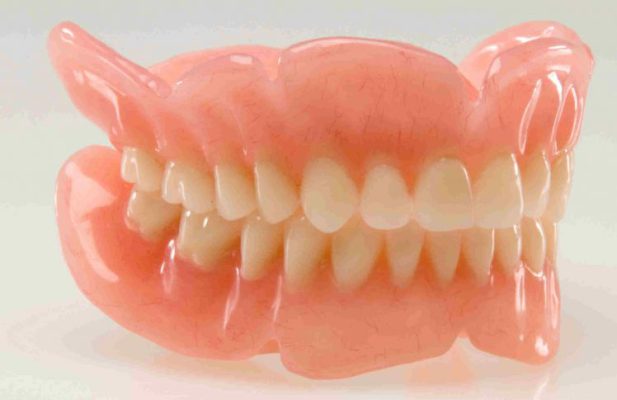 دندان لمینتی